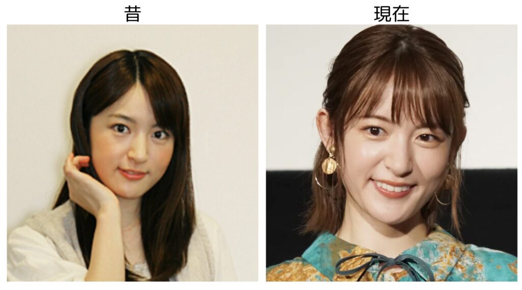 小松未可子の昔と現在の比較画像２