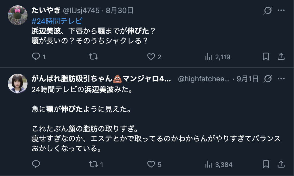 浜辺美波の顎が長いというXのコメント