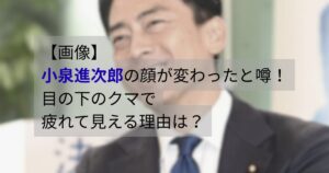 小泉進次郎の顔が変わったと噂｜目の下のクマで疲れて見える理由を解説