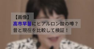 高市早苗の昔と現在の写真を比較し、ヒアルロン酸の噂について検証するイメージ画像