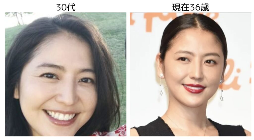長澤まさみの30代と36歳のビジュアルの比較