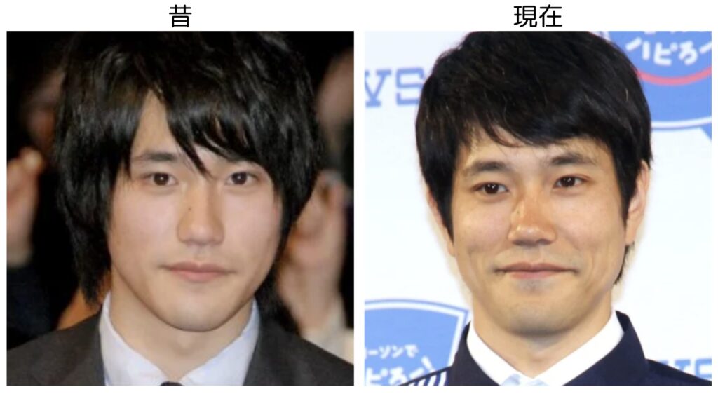 松山ケンイチの20代の頃と現在の髭無しの時の比較画像