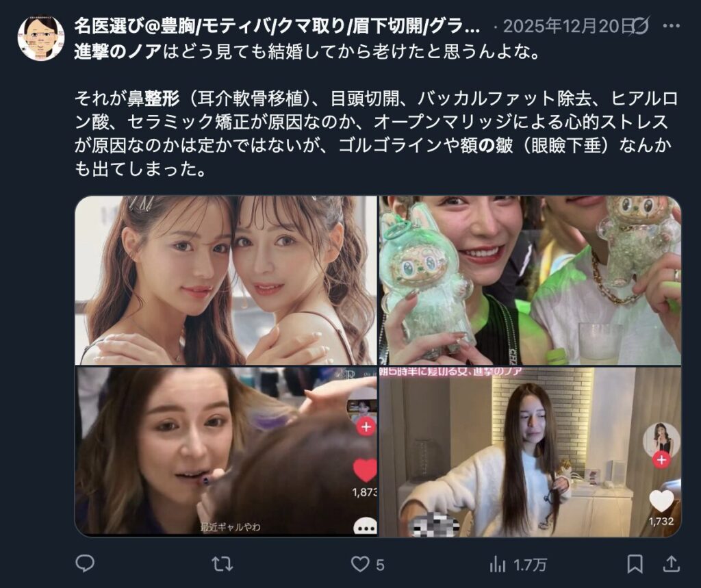 進撃のノアの顔を整形しすぎという意見