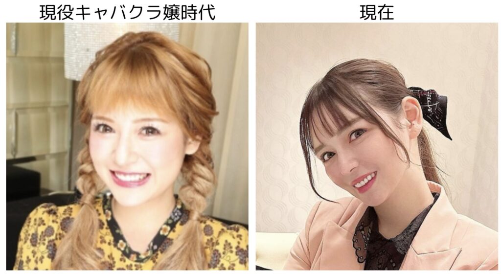 進撃のノアの現役時代と現在の比較１