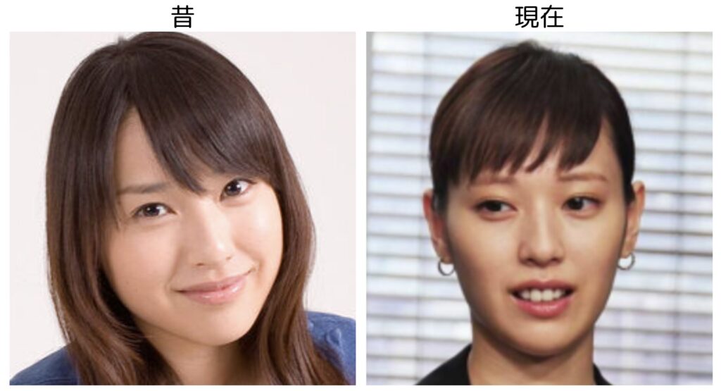 戸田恵梨香の昔の頬がふっくらした画像と現在のほっそりした比較画像