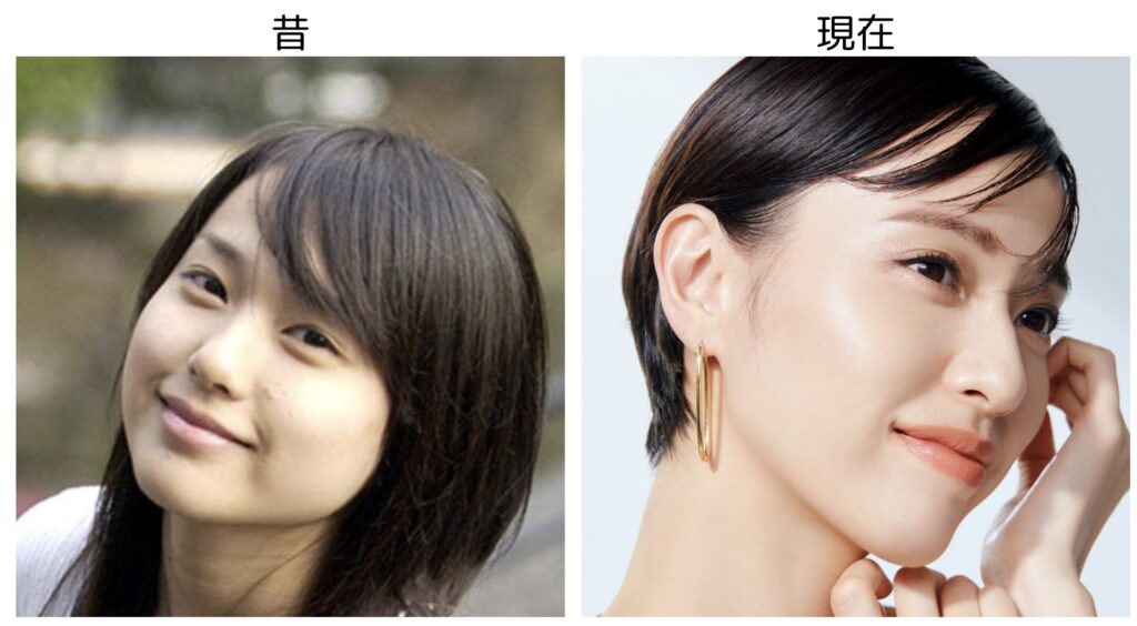 戸田恵梨香の昔の頬がふっくらした画像と現在のほっそりした比較画像２