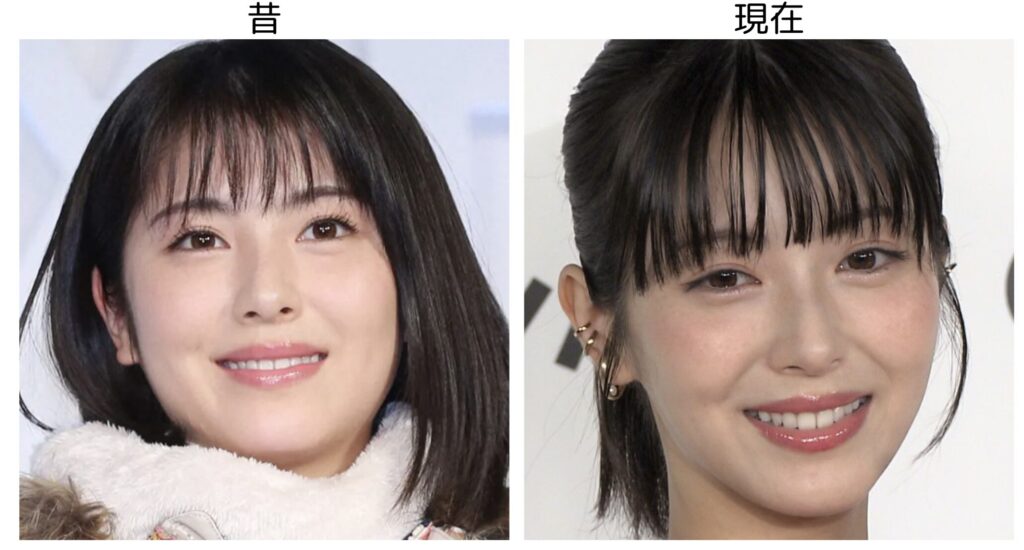 浜辺美波の昔と現在の比較写真
