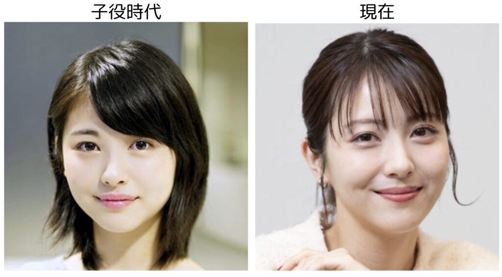 浜辺美波の子役時代と25歳の頃を比較した画像２