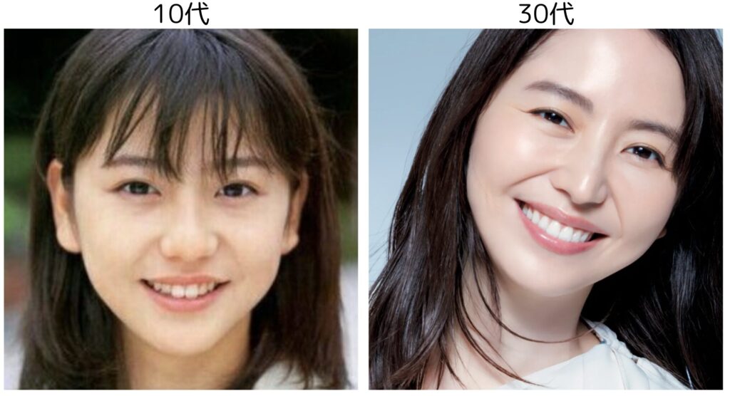 長澤まさみの10代と30代の比較画像３