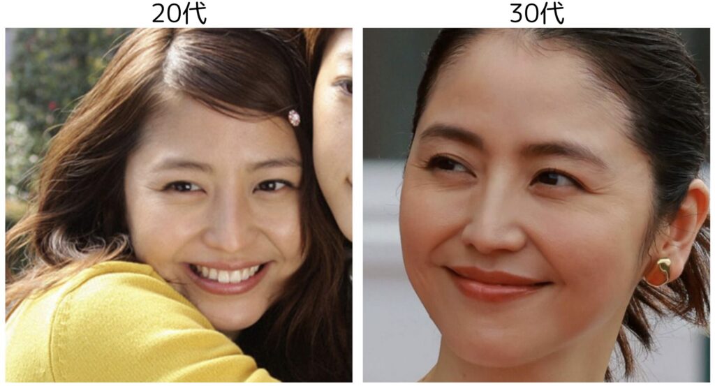 長澤まさみの20代と30代の比較画像2