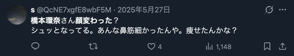 橋本環奈が痩せたように感じるとの声