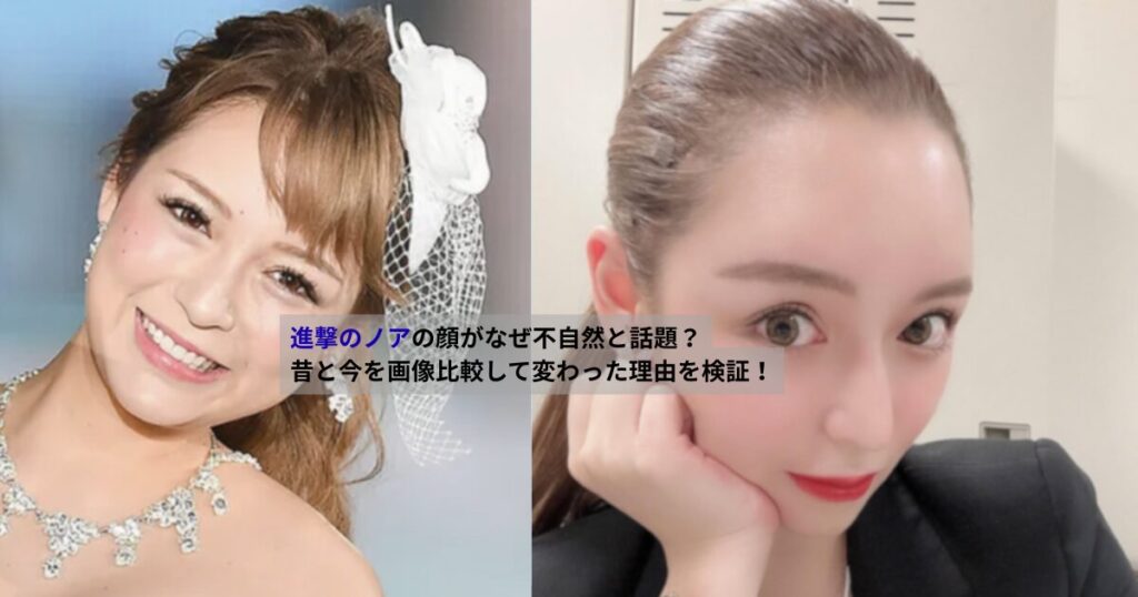 進撃のノアの昔と現在の顔を並べて比較した画像。キャバクラ嬢時代と経営者として活動する現在の表情や輪郭の違いが分かるビフォーアフター写真。