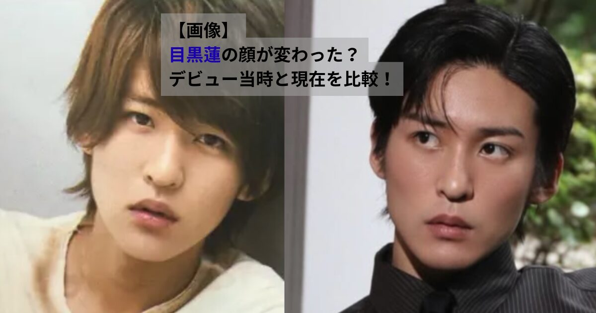 目黒蓮のデビュー当時と現在の顔を比較した画像。ヘアスタイルや表情の違いから、垢抜けた印象の変化が分かる。