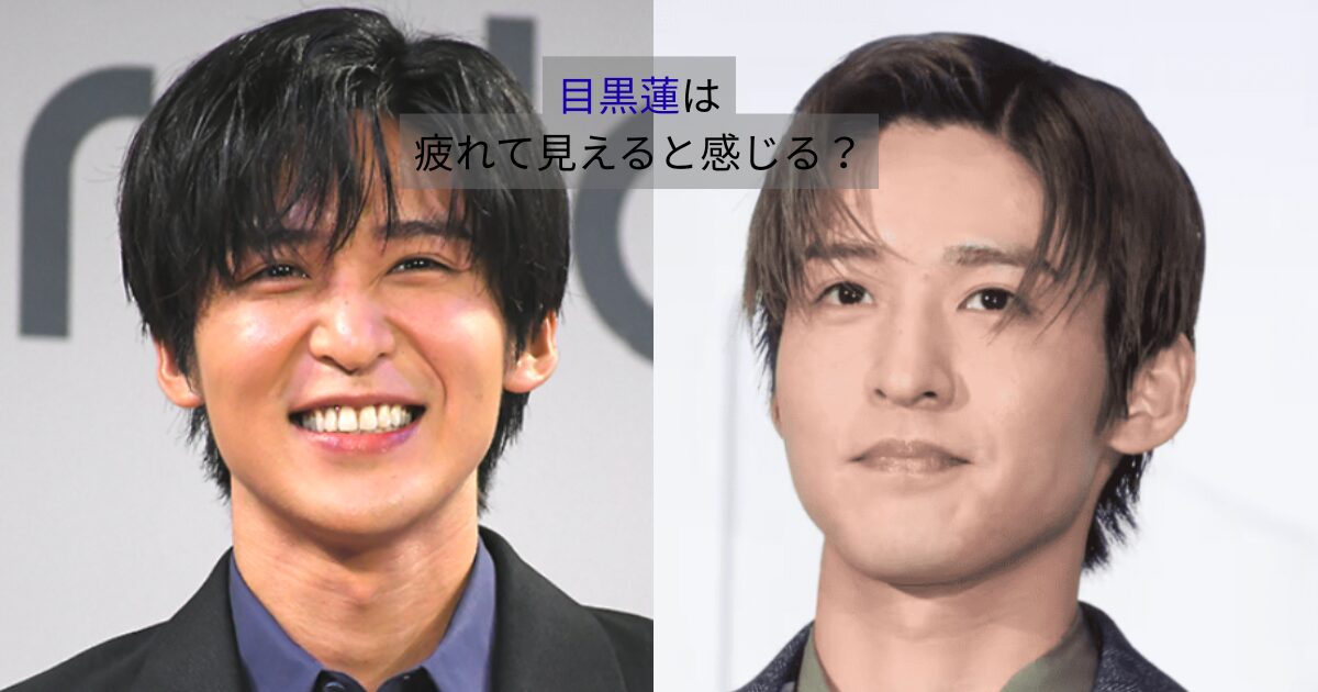 目黒蓮の写真を左右で比較し、表情や顔色の違いによって疲れて見える印象が変わる様子を示した画像