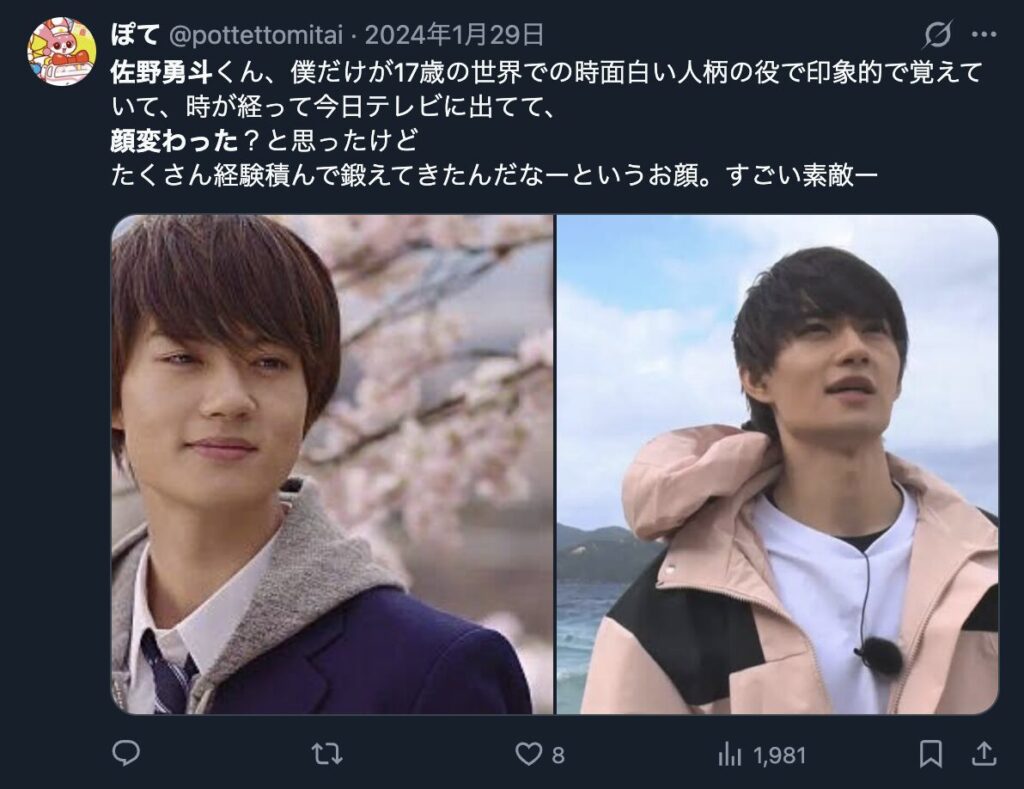 佐野勇斗の顔が変わったという意見