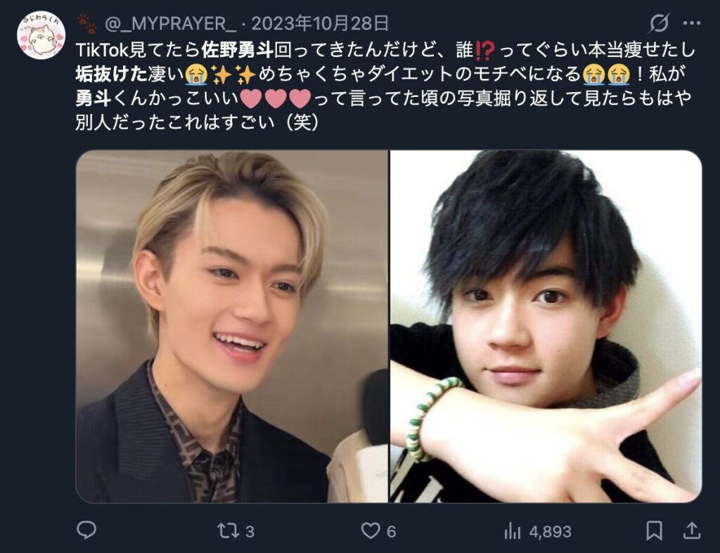 佐野勇斗が痩せて顔が変わったという意見２