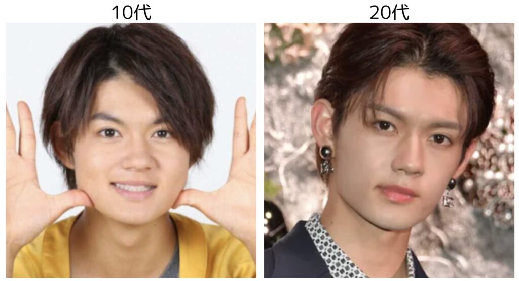 佐野勇斗の10代と20代の比較２