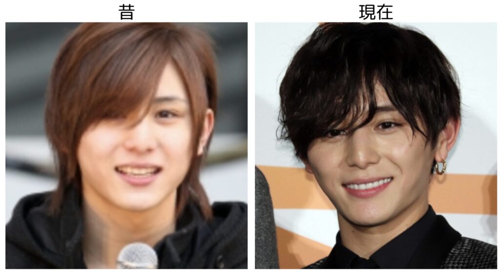 山田涼介の笑顔の昔と現在の比較画像２