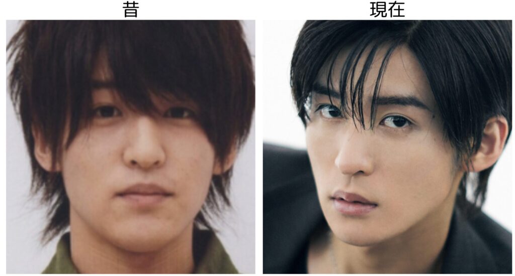 目黒蓮の昔と現在の比較画像１