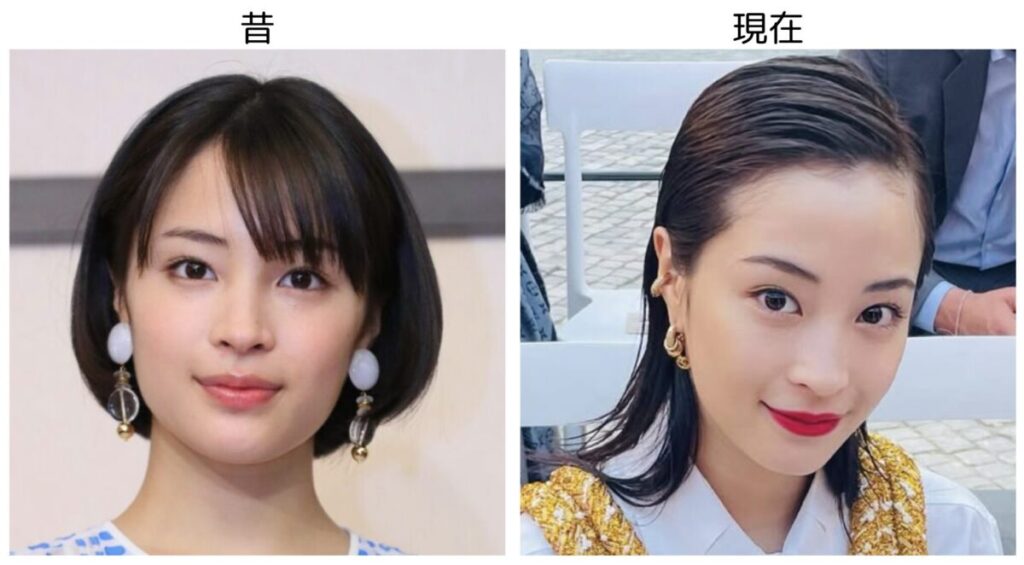 広瀬すずの10代の頃と20代の比較