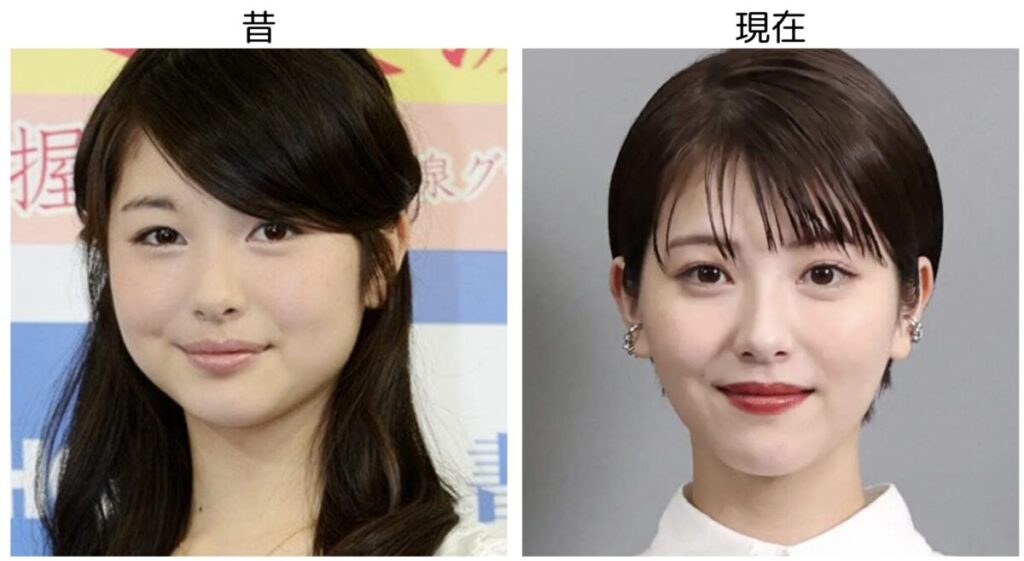 浜辺美波の昔と現在の比較画像２