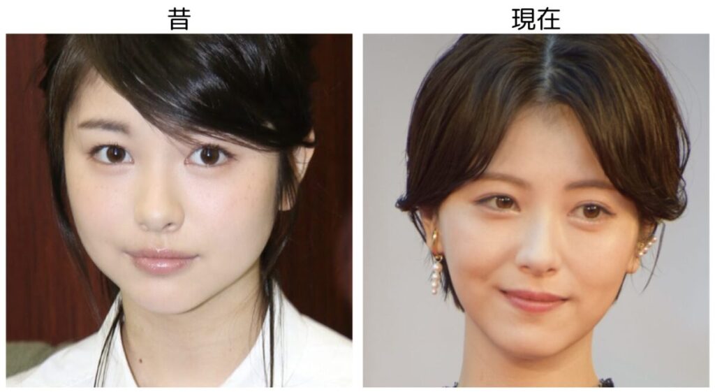 浜辺美波の昔と現在の比較画像