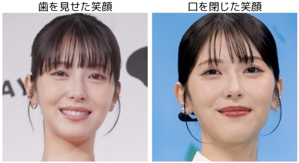 浜辺美波の口を閉じた笑顔と開いた笑顔の比較画像