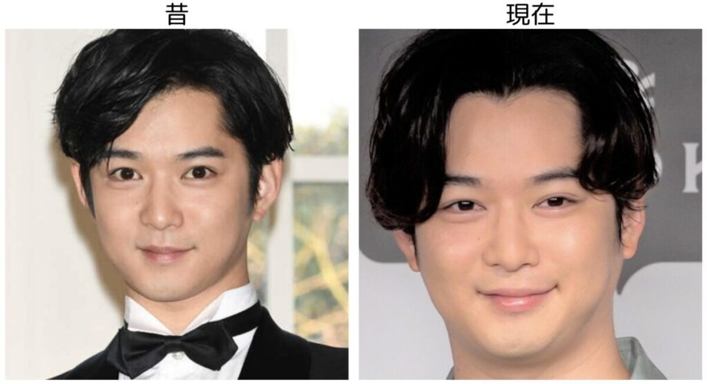 千葉雄大の昔と現在の比較画像２