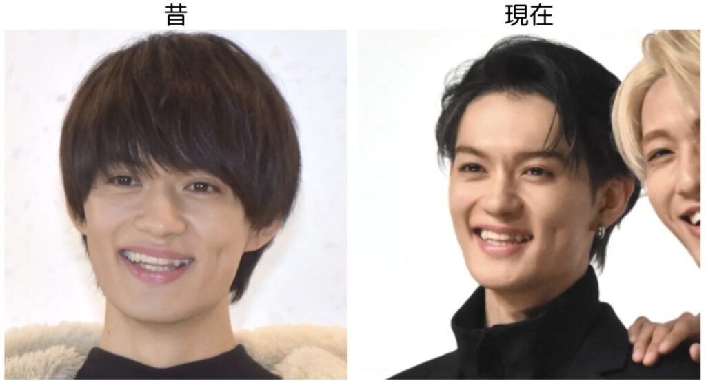 佐野勇斗の昔と現在の比較画像