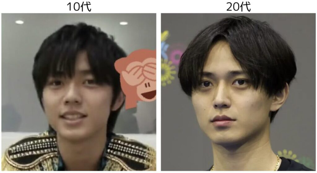 永瀬廉の10代の頃と20代の比較画像1