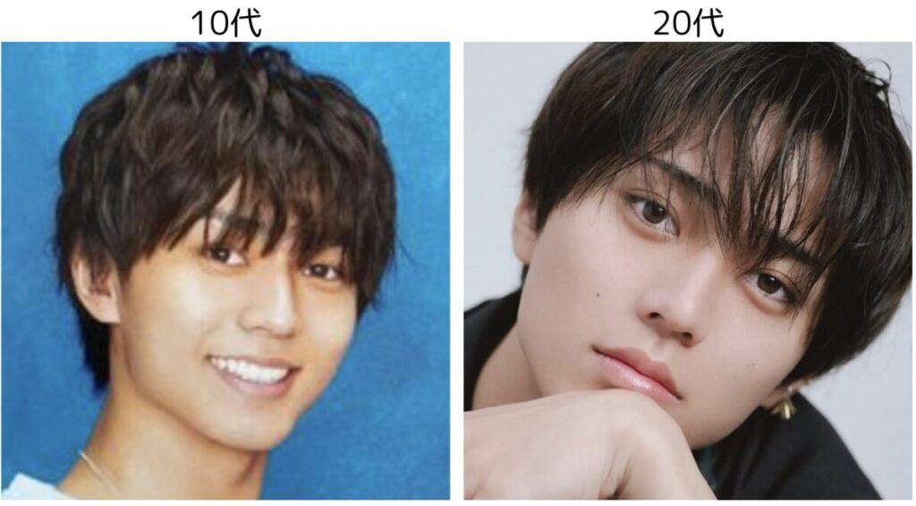 永瀬廉の10代と20代の比較2