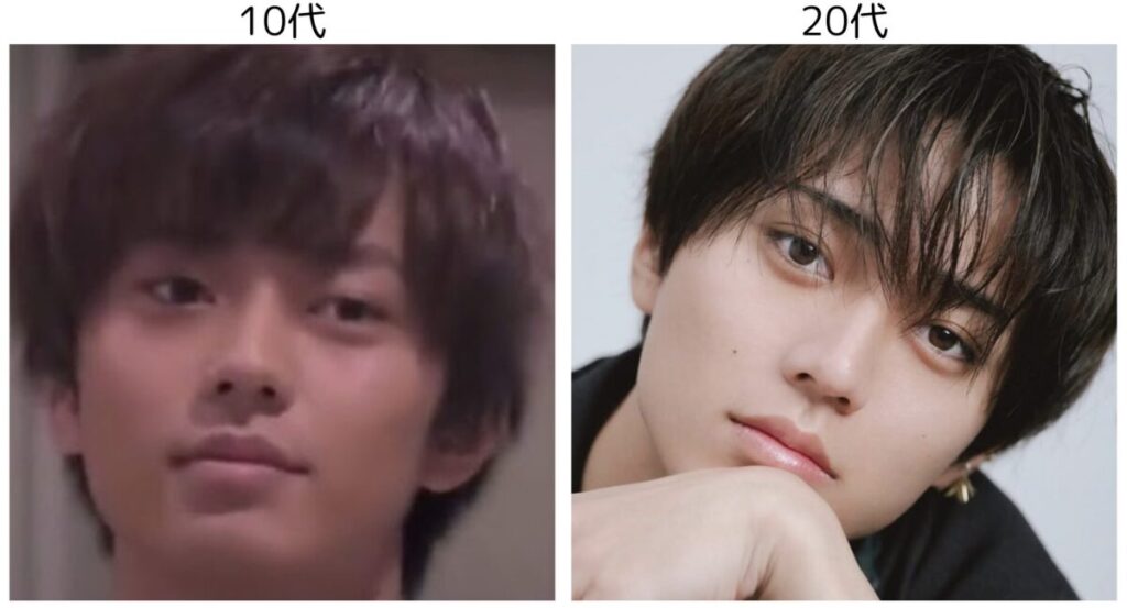 永瀬廉の10代と20代の比較3