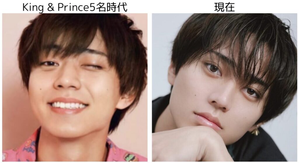 永瀬廉のキンプリ5名体制の時代と現在の比較1