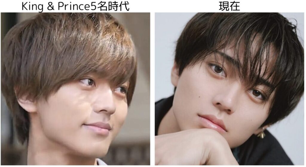 永瀬廉のキンプリ5名体制の時代と現在の比較4