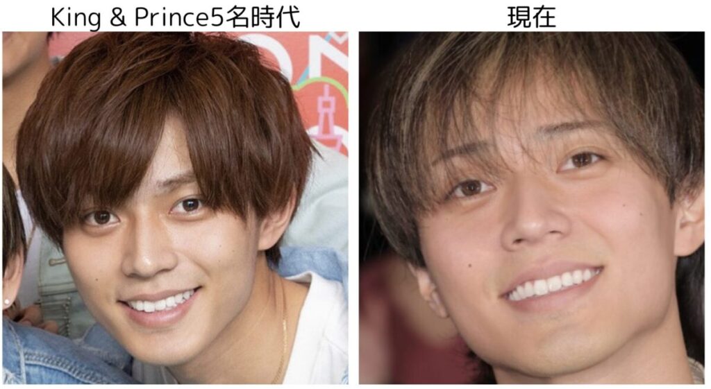 永瀬廉のキンプリ5名体制の時代と現在の比較2