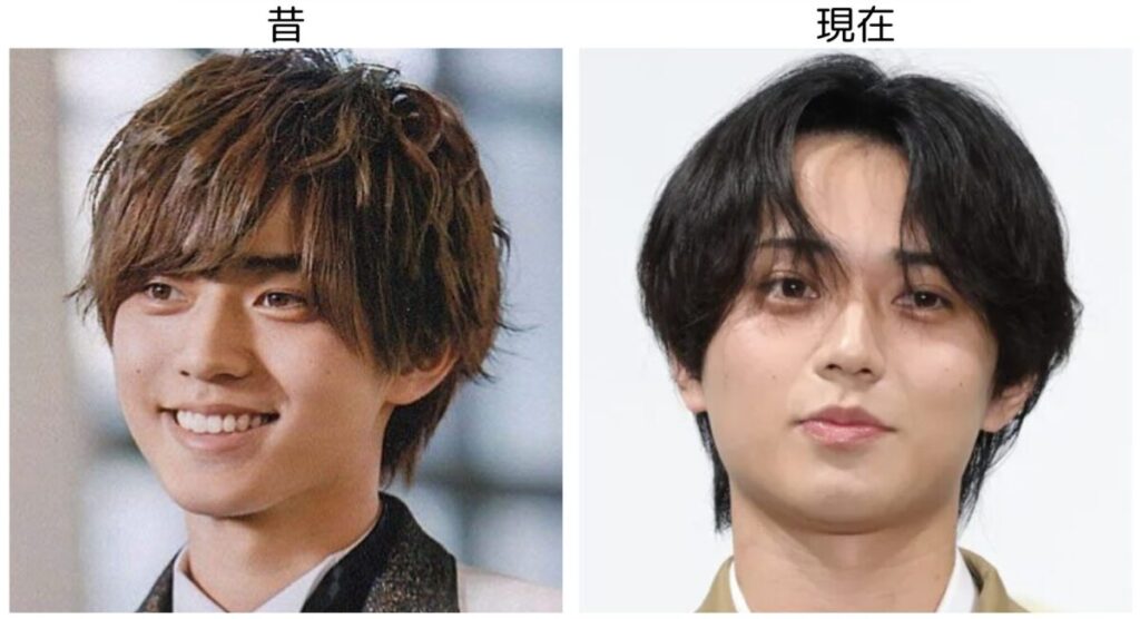 永瀬廉の昔と現在の比較1