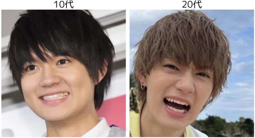 １０代と２０代の頃の佐野勇斗の比較画像３