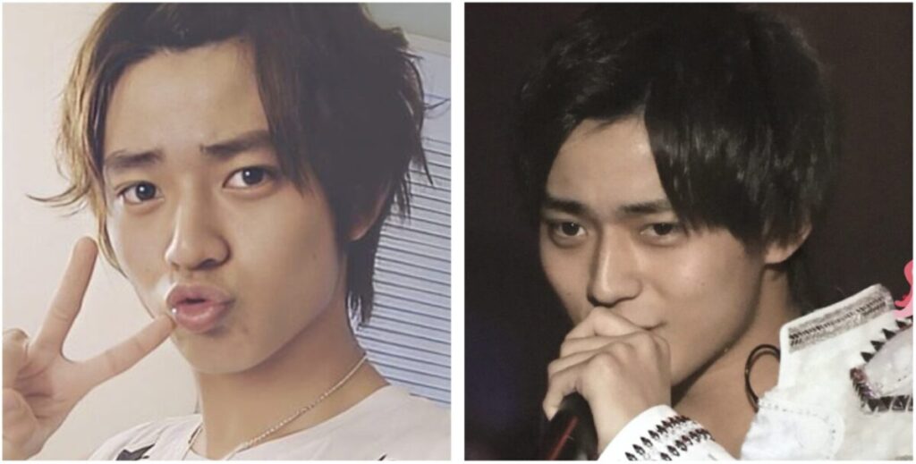 永瀬廉のデコ出しスタイル