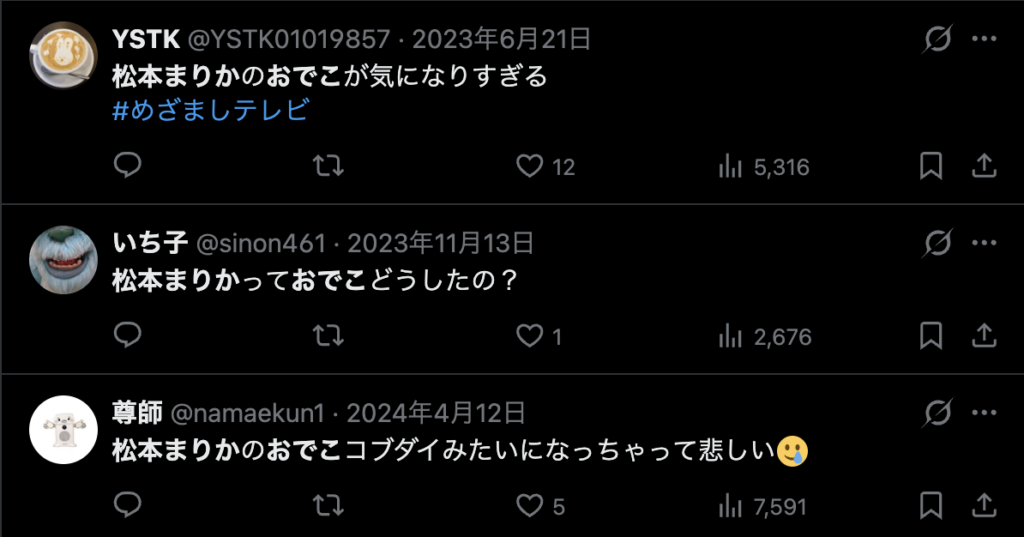 松本まりかのおでこが不自然というコメント