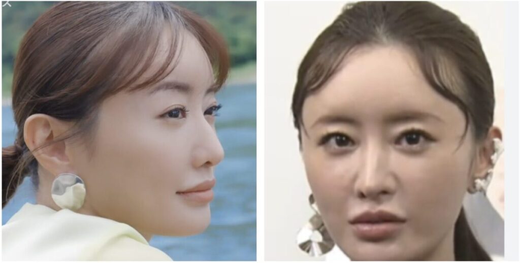 松本まりかのおでこが不自然に見える画像1