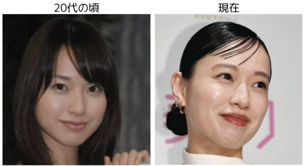 戸田恵梨香の20代と現在の比較画像2
