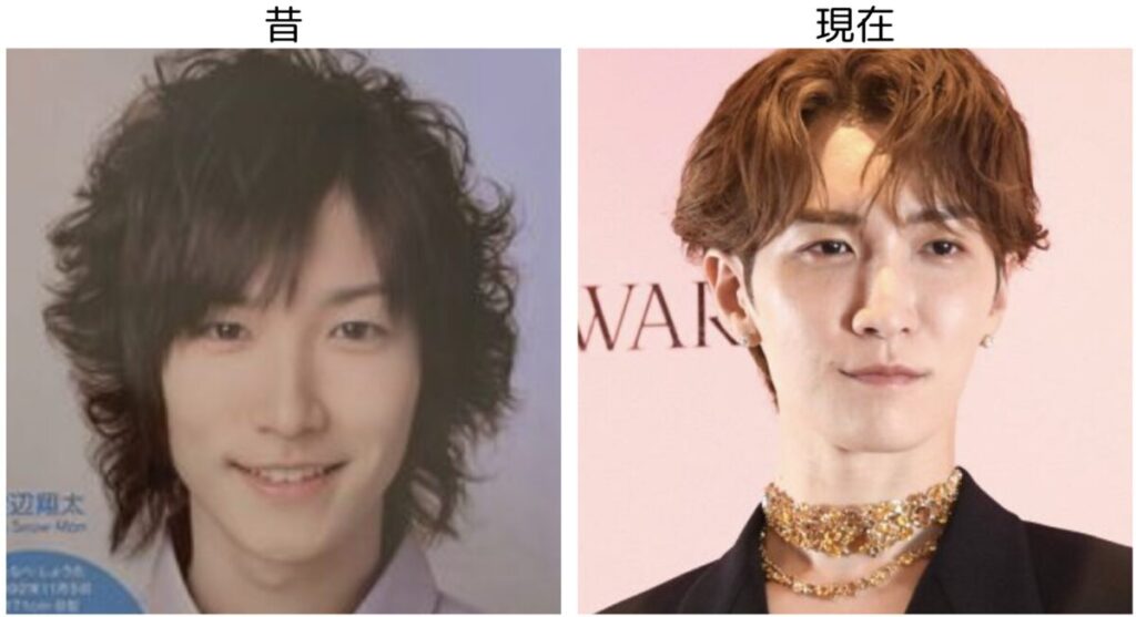 渡辺翔太の昔の頃と現在の比較画像