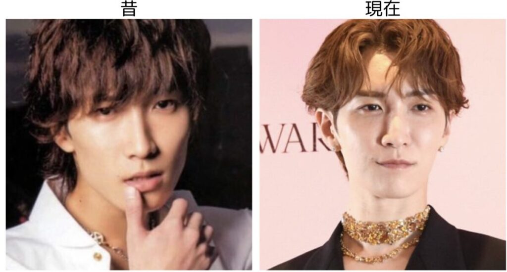 渡辺翔太の昔の頃と現在の比較画像３
