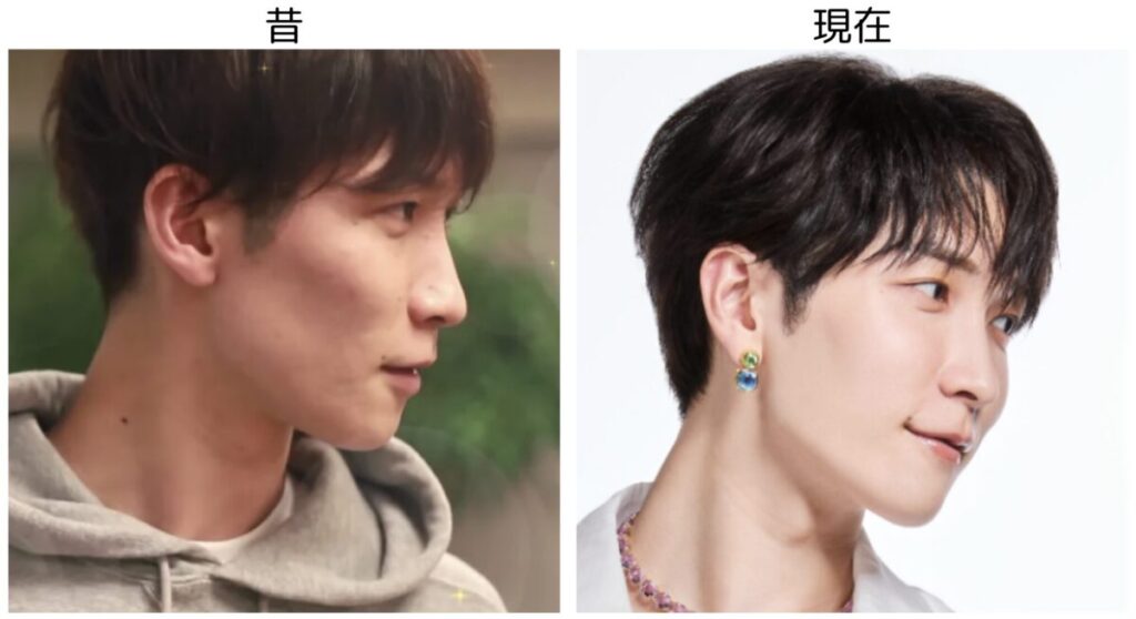 渡辺翔太の横顔の昔と現在の比較画像