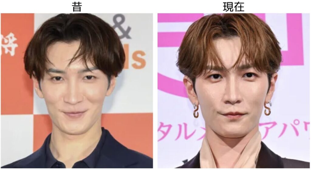 渡辺翔太の昔と現在の比較画像2