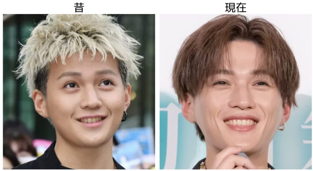 八木勇征の昔と現在の比較画像2
