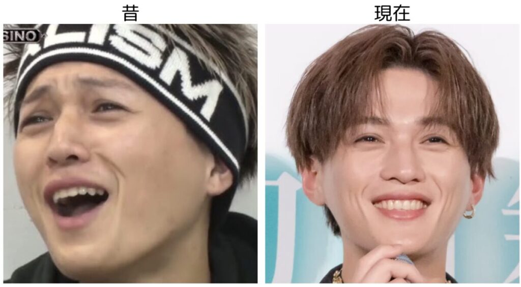 八木勇征の昔と現在の比較画像1