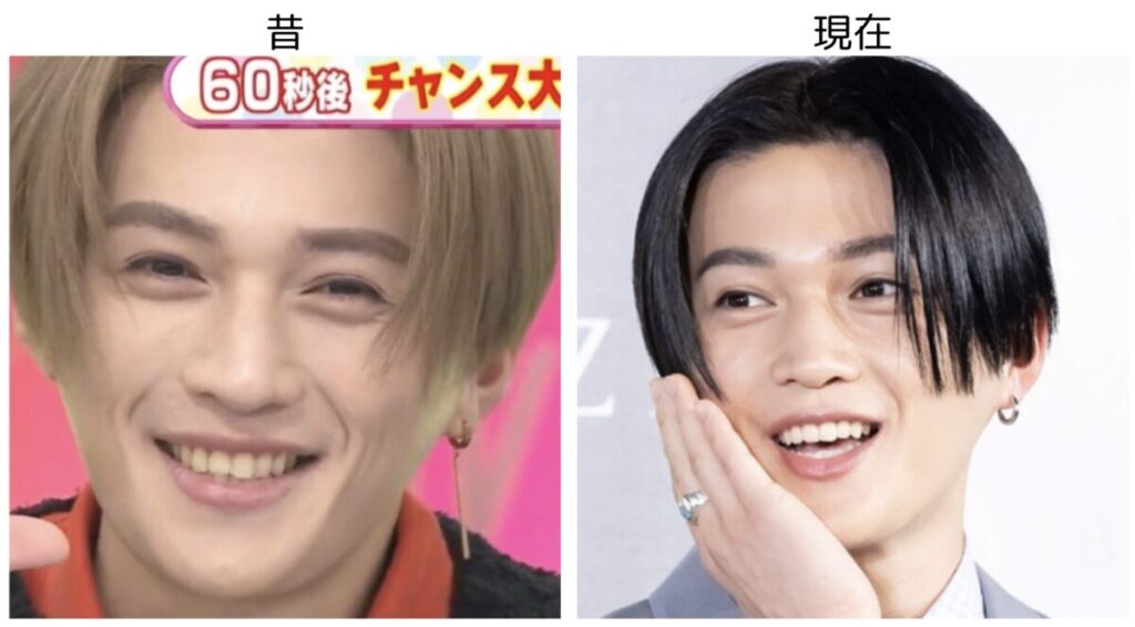 八木勇征の昔と現在の比較画像3
