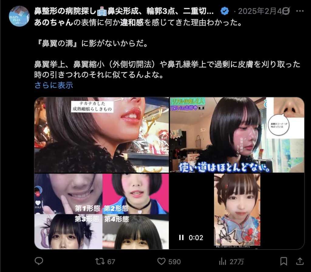 あのちゃんの鼻に違和感を感じるという意見２