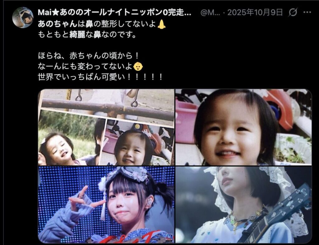 あのちゃんの鼻は変わっていないという頃